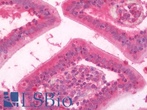 Human Small Intestine: Formalin-Fixed, Paraffin-Embedded (FFPE)