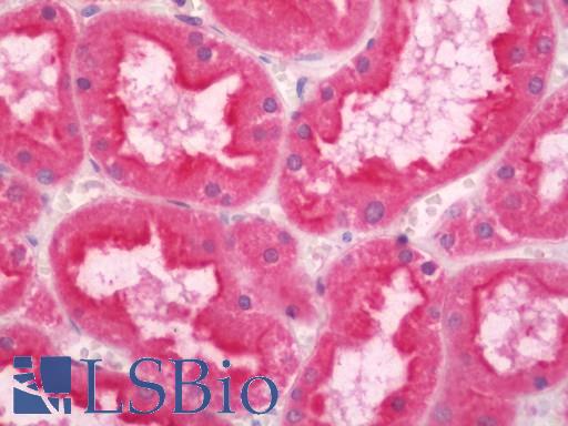 Human Kidney: Formalin-Fixed, Paraffin-Embedded (FFPE)