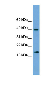 ATP6V1G2 antibody LS-C135464 Western blot of Fetal Brain lysate.