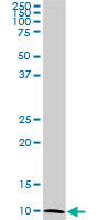 ATP6V1G2 monoclonal antibody (M02), clone 2E11. Western Blot analysis of ATP6V1G2 expression in NIH/3T3.