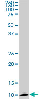 ATP6V1G2 monoclonal antibody (M02), clone 2E11. Western Blot analysis of ATP6V1G2 expression in PC-12.
