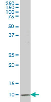 ATP6V1G2 monoclonal antibody (M02), clone 2E11 Western Blot analysis of ATP6V1G2 expression in HepG2.