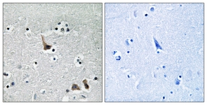 IHC of paraffin-embedded human brain tissue, using ATP6V1H Antibody. The picture on the right is treated with the synthesized peptide.