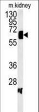 Western blot of ATP6V1H Antibody in mouse kidney tissue lysates (35 ug/lane). ATP6V1H (arrow) was detected using the purified antibody.