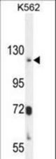 ATP8A2 Antibody western blot of K562 cell line lysates (35 ug/lane). The ATP8A2 antibody detected the ATP8A2 protein (arrow).