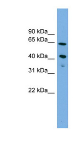 ATP8B2 antibody LS-C116270 Western blot of Jurkat lysate.