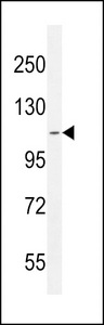 AT8B2 Antibody western blot of CEM cell line lysates (35 ug/lane). The AT8B2 antibody detected the AT8B2 protein (arrow).
