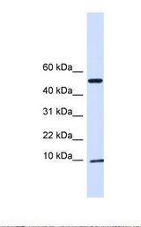 293T cell lysate. Antibody concentration: 1.0 ug/ml. Gel concentration: 10-20%.
