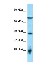 C2orf28 antibody LS-C146456 Western blot of 1 Cell lysate. Antibody concentration 1 ug/ml.