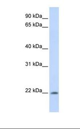 Fetal muscle lysate. Antibody concentration: 1.0 ug/ml. Gel concentration: 12%.