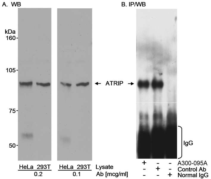 Detection of Human ATRIP by Western Blot and Immunoprecipitation. Samples: Whole cell lysate (100 ug for WB; 400 ug for IP) from HeLa (A & B) and 293-T (A) cells. Antibodies: Affinity purified rabbit anti-ATRIP antibody used at the indicated concentrations for WB and 3 ug/0.4 mg lysate for IP. ATRIP was also Immunoprecipitated using a control antibody generated to recombinant human ATRIP. Immunoprecipitated ATRIP was detected using the antibody to the recombinant protein. Detection: Chemiluminescence with exposure times of 5 minutes (A) and 45 seconds (B).