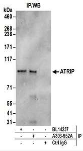 Detection of Human ATRIP by Western Blot of Immunoprecipitates. Samples: Whole cell lysate (1 mg for IP; 20% of IP loaded) from HeLa cells. Antibodies: Affinity purified rabbit anti-ATRIP antibody used for IP at 6 ug/mg lysate. ATRIP was also immunoprecipitated by rabbit anti-ATRIP antibody BL14237. For blotting immunoprecipitated ATRIP, was used at 1 ug/ml. Detection: Chemiluminescence with an exposure time of 30 seconds.
