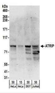 Detection of Human ATRIP by Western Blot. Samples: Whole cell lysate from HeLa (15 and 50 ug), 293T (50 ug), and Jurkat (50 ug) cells. Antibodies: Affinity purified rabbit anti-ATRIP antibody used for WB at 0.4 ug/ml. Detection: Chemiluminescence with an exposure time of 3 minutes.