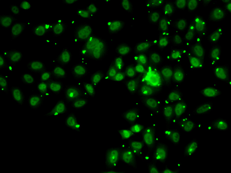 Immunofluorescence blot of A549 cell using ATRIP antibody.