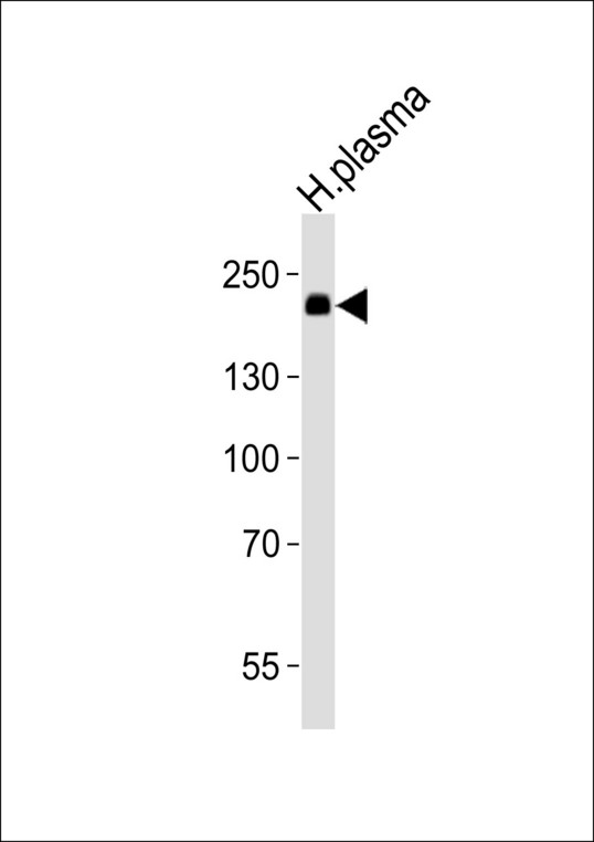 Western blot of lysate from human plasma tissue lysate with ATRN Antibody. Antibody was diluted at 1:1000. A goat anti-rabbit IgG H&L (HRP) at 1:10000 dilution was used as the secondary antibody. Lysate at 35 ug.