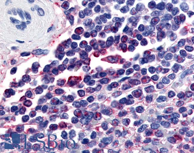 Anti-ATRN / Attractin antibody LS-A8316 IHC of human spleen. Immunohistochemistry of formalin-fixed, paraffin-embedded tissue after heat-induced antigen retrieval.