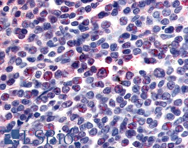 Anti-ATRN / Attractin antibody LS-A8292 IHC of human spleen. Immunohistochemistry of formalin-fixed, paraffin-embedded tissue after heat-induced antigen retrieval.