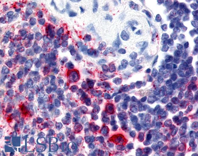 Anti-ATRN / Attractin antibody LS-A8290 IHC of human spleen. Immunohistochemistry of formalin-fixed, paraffin-embedded tissue after heat-induced antigen retrieval.