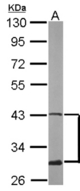 Sample (50 ug of whole cell lysate). A: mouse brain. 10% SDS PAGE. ATXN3 / JOS antibody diluted at 1:500.