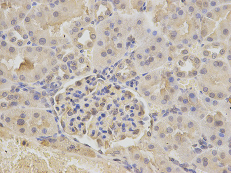 Immunohistochemistry of paraffin-embedded rat kidney using ATXN3 antibody at dilution of 1:200 (400x lens).