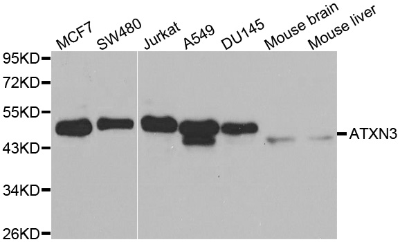 Western blot analysis of extracts of various cell lines, using ATXN3 antibody.