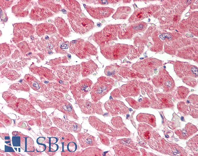 Human Heart: Formalin-Fixed, Paraffin-Embedded (FFPE)