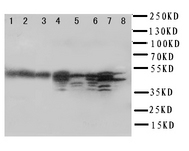 WB of ATXN3 / JOS antibody. Lane 1: Rat Brain Tissue Lysate. Lane 2: Rat Heart Tissue Lysate. Lane 3: Rat Placenta Tissue Lysate. Lane 4: HELA Cell Lysate. Lane 5: PANC Cell Lysate. Lane 6: SMMC Cell Lysate. Lane 7: COLO320 Cell Lysate. Lane 8: MCF-7 Cell Lysate.