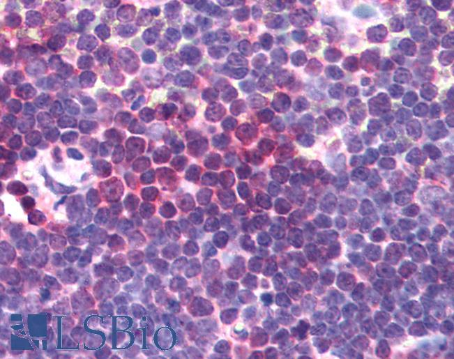 Anti-AURKA / Aurora-A antibody IHC of human thymus. Immunohistochemistry of formalin-fixed, paraffin-embedded tissue after heat-induced antigen retrieval. Antibody LS-B191 concentration 10 ug/ml.