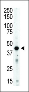 The STK12 polyclonal antibody is used in Western blot to detect STK12 in mouse spleen tissue lysate.