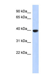 AURKC / Aurora-C antibody LS-C111533 Western blot of Fetal Pancreas lysate.