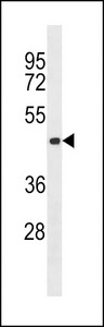 Aurora-C Antibody (Ctr) western blot of 293 cell line lysates (35 ug/lane). The Aurora-C antibody detected the Aurora-C protein (arrow).