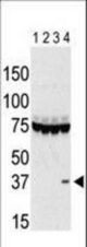 The anti-Aurora C antibody is used in Western blot to detect Aurora C in lysates of 293 cells expressing Flag tag (lane 1), Flag-tagged Aurora A (lane 2), Flag-tagged Aurora B (lane 3), and Flag-tagged Aurora C (lane 4). Data is kindly provided by Drs. K. Sasai and S. Sen from the University of Texas MD Anderson Cancer Center (Houston, TX).