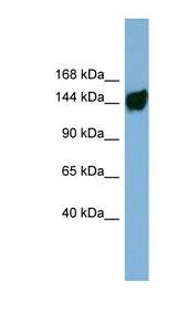 AASDH antibody LS-C107799 Western blot of ACHN lysate.