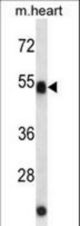 ATG4C Antibody western blot of mouse heart tissue lysates (35 ug/lane). The ATG4C antibody detected the ATG4C protein (arrow).