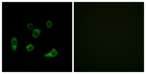 Immunofluorescence of HUVEC cells, using ATG4C Antibody. The picture on the right is treated with the synthesized peptide.