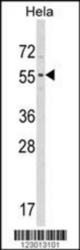 Western blot of ATG4C Antibody in HeLa cell line lysates (35 ug/lane). ATG4C (arrow) was detected using the purified Pab.