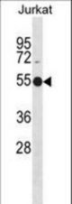 APG4C Antibody (Y48) western blot of Jurkat cell line lysates (35 ug/lane). The APG4C antibody detected the APG4C protein (arrow).