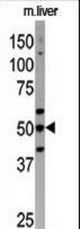 The anti-APG4C antibody is used in Western blot to detect APG4C in mouse liver tissue lysate
