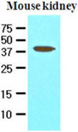 The extracts of mouse kidney (50 ug) were resolved by SDS-PAGE, transferred to NC membrane and probed with anti-human PDCD12 (1:1000). Proteins were visualized using a goat anti-mouse secondary antibody conjugated to HRP and an ECL detection system.
