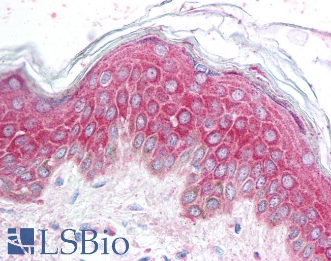 Anti-AVEN antibody IHC of human skin. Immunohistochemistry of formalin-fixed, paraffin-embedded tissue after heat-induced antigen retrieval. Antibody LS-B1330 concentration 5 ug/ml.
