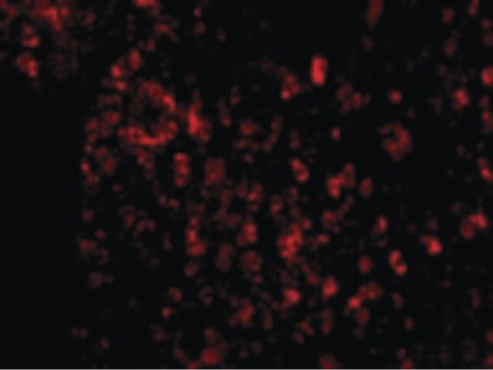 Immunofluorescence of AVEN in Human Spleen cells with AVEN antibody at 20 ug/ml.