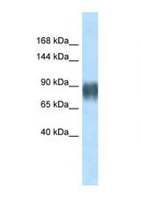 AVIL / Advillin antibody LS-C145423 Western blot of Rat Muscle lysate. Antibody concentration 1 ug/ml.