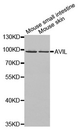 Western blot analysis of extracts of various cell lines, using AVIL antibody.