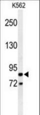 Western blot of AVIL Antibody in K562 cell line lysates (35 ug/lane). AVIL (arrow) was detected using the purified antibody.