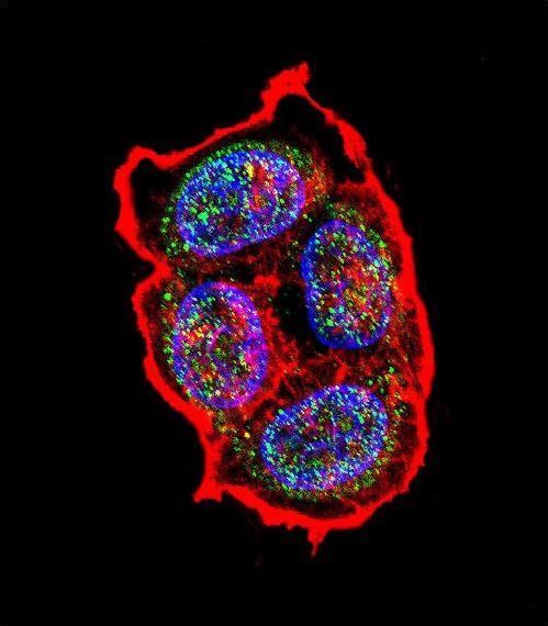 Confocal immunofluorescent of AVP Antibody with ZR-75-1 cell followed by Alexa Fluor 488-conjugated goat anti-rabbit lgG (green). Actin filaments have been labeled with Alexa Fluor 555 phalloidin (red). DAPI was used to stain the cell nuclear (blue).