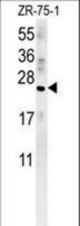 AVP Antibody western blot of ZR-75-1 cell line lysates (15 ug/lane). The AVP antibody detected the AVP protein (arrow).
