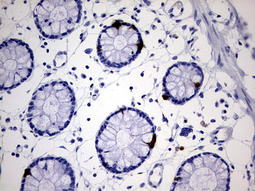 IHC of paraffin-embedded Human colon tissue using anti-AVPI1 mouse monoclonal antibody. (Heat-induced epitope retrieval by 1 mM EDTA in 10mM Tris, pH9.0, 120°C for 3min).