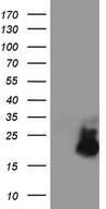 HEK293T cells were transfected with the pCMV6-ENTRY control (Left lane) or pCMV6-ENTRY AVPI1 (Right lane) cDNA for 48 hrs and lysed. Equivalent amounts of cell lysates (5 ug per lane) were separated by SDS-PAGE and immunoblotted with anti-AVPI1.