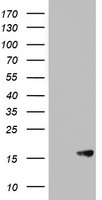 HEK293T cells were transfected with the pCMV6-ENTRY control (Left lane) or pCMV6-ENTRY AVPI1 (Right lane) cDNA for 48 hrs and lysed. Equivalent amounts of cell lysates (5 ug per lane) were separated by SDS-PAGE and immunoblotted with anti-AVPI1.