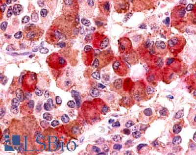 Anti-AVPR1B antibody LS-A3739 IHC of human pituitary, anterior. Immunohistochemistry of formalin-fixed, paraffin-embedded tissue after heat-induced antigen retrieval.
